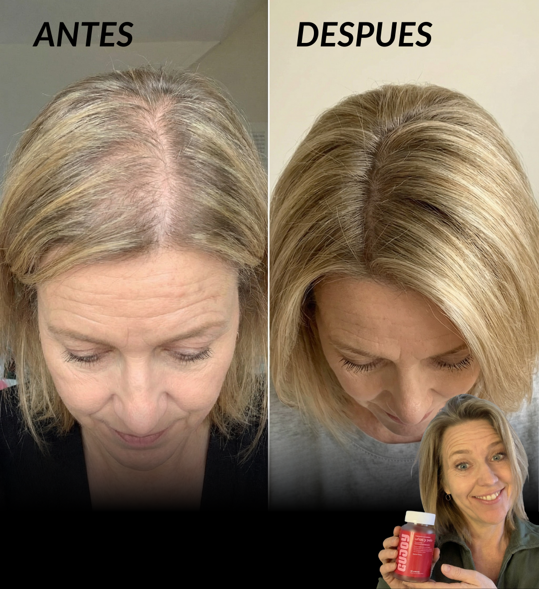 Haar- und Nagelgummibärchen